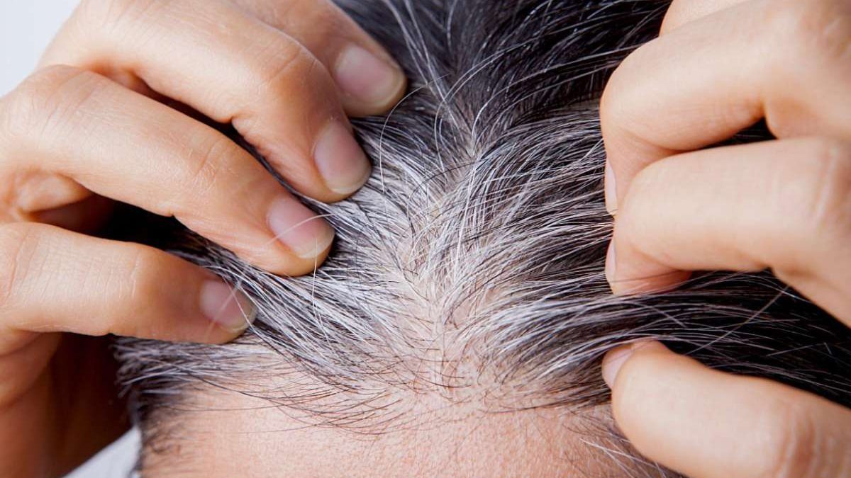 know-the-causes-of-white-hair-and-easy-ways-to-prevent-it-naturally