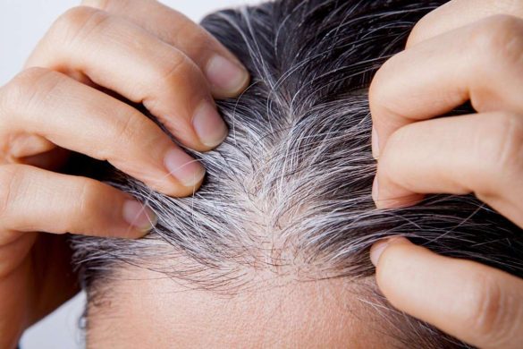 wellhealthorganic.com/know-the-causes-of-white-hair-and-easy-ways-to-prevent-it-naturally